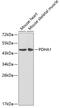 Pyruvate Dehydrogenase E1 Alpha 1 Subunit antibody, 18-369, ProSci, Western Blot image 