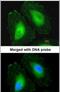 Crystallin Beta A4 antibody, PA5-22032, Invitrogen Antibodies, Immunofluorescence image 