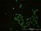 CD58 Molecule antibody, H00000965-M01, Novus Biologicals, Immunocytochemistry image 