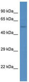 Ankyrin Repeat Domain 13D antibody, TA335105, Origene, Western Blot image 