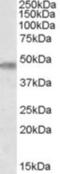 Target Of Myb1 Like 1 Membrane Trafficking Protein antibody, NBP1-00246, Novus Biologicals, Western Blot image 