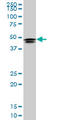 Homeobox D3 antibody, LS-C197449, Lifespan Biosciences, Western Blot image 
