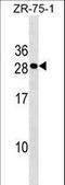 C-Type Lectin Domain Containing 9A antibody, LS-C159368, Lifespan Biosciences, Western Blot image 