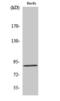 Leucine Rich Repeat Containing G Protein-Coupled Receptor 6 antibody, PA5-50997, Invitrogen Antibodies, Western Blot image 