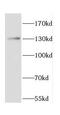 Caspase Recruitment Domain Family Member 6 antibody, FNab01270, FineTest, Western Blot image 