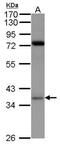 Ribose-phosphate pyrophosphokinase 1 antibody, PA5-27749, Invitrogen Antibodies, Western Blot image 