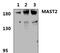 Microtubule Associated Serine/Threonine Kinase 2 antibody, PA5-75974, Invitrogen Antibodies, Western Blot image 
