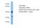 3-Hydroxyisobutyryl-CoA Hydrolase antibody, A08660, Boster Biological Technology, Western Blot image 