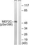 Myocyte Enhancer Factor 2C antibody, abx012699, Abbexa, Western Blot image 