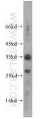 Ribosomal Protein L13a antibody, 14633-1-AP, Proteintech Group, Western Blot image 