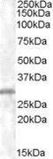 Charged Multivesicular Body Protein 5 antibody, GTX89565, GeneTex, Western Blot image 