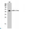 Mitogen-Activated Protein Kinase Kinase 2 antibody, LS-C814171, Lifespan Biosciences, Western Blot image 
