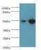 Isocitrate Dehydrogenase (NADP(+)) 2, Mitochondrial antibody, LS-C375937, Lifespan Biosciences, Western Blot image 