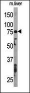 Autophagy Related 7 antibody, PA5-35203, Invitrogen Antibodies, Western Blot image 