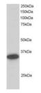 Carbonyl Reductase 1 antibody, orb66478, Biorbyt, Western Blot image 