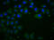 Cadherin 1 antibody, CSB-MA005034A0m, Cusabio, Immunofluorescence image 