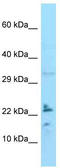 Interleukin 24 antibody, TA337584, Origene, Western Blot image 