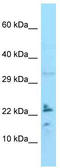 Interleukin-24 antibody, TA337584, Origene, Western Blot image 