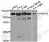 HAUS Augmin Like Complex Subunit 3 antibody, A8258, ABclonal Technology, Western Blot image 