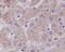 Glutamate-Ammonia Ligase antibody, M03191, Boster Biological Technology, Immunohistochemistry paraffin image 