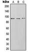 DnaJ Heat Shock Protein Family (Hsp40) Member B1 antibody, orb214068, Biorbyt, Western Blot image 