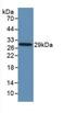 Toll Like Receptor 8 antibody, abx131785, Abbexa, Western Blot image 