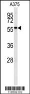 NGFI-A Binding Protein 2 antibody, 63-078, ProSci, Western Blot image 