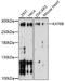 Lysine Acetyltransferase 6B antibody, 16-870, ProSci, Western Blot image 