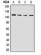 Nucleoporin 98 antibody, LS-C667762, Lifespan Biosciences, Western Blot image 