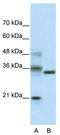 Class B basic helix-loop-helix protein 42 antibody, TA339529, Origene, Western Blot image 