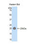 Hexosaminidase Subunit Beta antibody, LS-C297537, Lifespan Biosciences, Western Blot image 