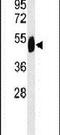 SET Domain Containing 6, Protein Lysine Methyltransferase antibody, PA5-24774, Invitrogen Antibodies, Western Blot image 