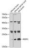 Receptor Accessory Protein 1 antibody, GTX55777, GeneTex, Western Blot image 