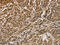 Calumenin antibody, CSB-PA987034, Cusabio, Immunohistochemistry paraffin image 
