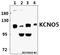 Potassium Voltage-Gated Channel Subfamily Q Member 5 antibody, A04705, Boster Biological Technology, Western Blot image 