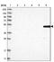 Major Facilitator Superfamily Domain Containing 6 Like antibody, NBP1-81967, Novus Biologicals, Western Blot image 