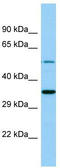 Ghrelin O-acyltransferase antibody, TA334324, Origene, Western Blot image 