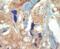Fms Related Tyrosine Kinase 3 antibody, PA5-14667, Invitrogen Antibodies, Immunohistochemistry frozen image 