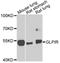 Glucagon Like Peptide 1 Receptor antibody, A00753, Boster Biological Technology, Western Blot image 