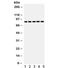 Transcription factor SOX-5 antibody, R32081, NSJ Bioreagents, Western Blot image 