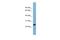 Charged Multivesicular Body Protein 1B antibody, A07069, Boster Biological Technology, Western Blot image 