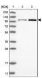 Glucosidase II Alpha Subunit antibody, NBP1-89806, Novus Biologicals, Western Blot image 
