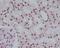 Poly(ADP-Ribose) Polymerase 1 antibody, M00122-1, Boster Biological Technology, Immunohistochemistry paraffin image 