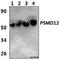 Proteasome 26S Subunit, Non-ATPase 12 antibody, A11756-1, Boster Biological Technology, Western Blot image 