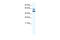 Zinc Finger And BTB Domain Containing 7A antibody, 28-615, ProSci, Enzyme Linked Immunosorbent Assay image 