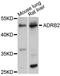 Adrenoceptor Beta 2 antibody, MBS126350, MyBioSource, Western Blot image 