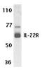 Interleukin 22 Receptor Subunit Alpha 1 antibody, TA306086, Origene, Western Blot image 