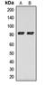 Lipase E, Hormone Sensitive Type antibody, orb256656, Biorbyt, Western Blot image 