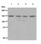 Chromatin Assembly Factor 1 Subunit A antibody, ab126625, Abcam, Western Blot image 