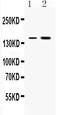 Insulin Receptor antibody, PB10072, Boster Biological Technology, Western Blot image 